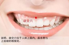 龈交穴位置图片和作用