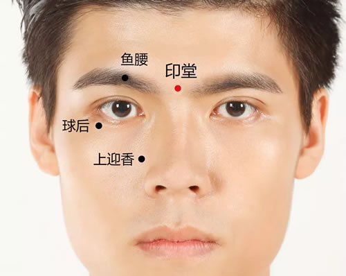 印堂穴