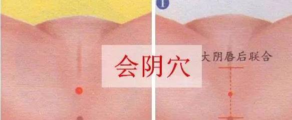 会阴穴位准确位置图