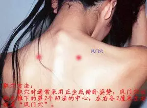 臀部痈肿艾灸取穴