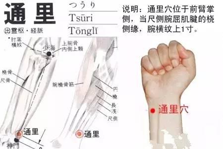 通里穴