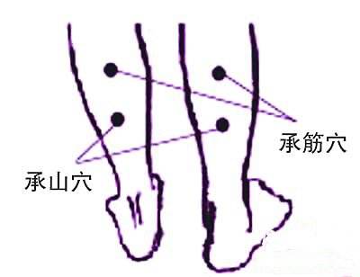 承筋穴