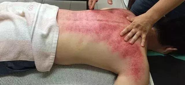 经络的作用