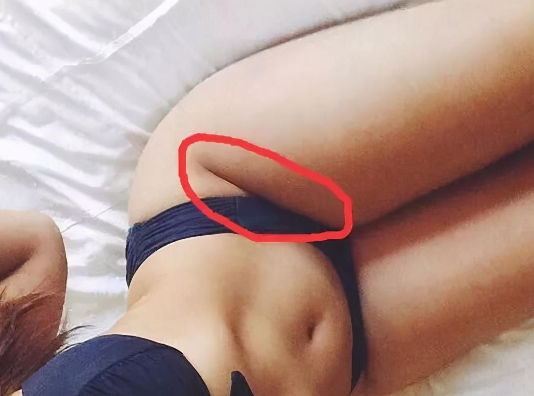 女性每天拍拍这条沟,不仅可治妇科病还可以变瘦!