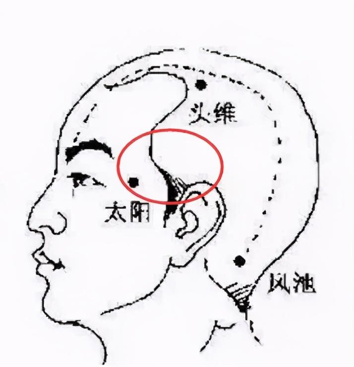 额头疼