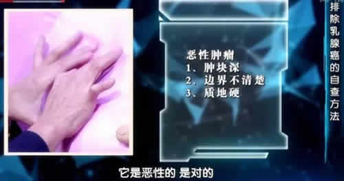 乳腺癌的15个征兆